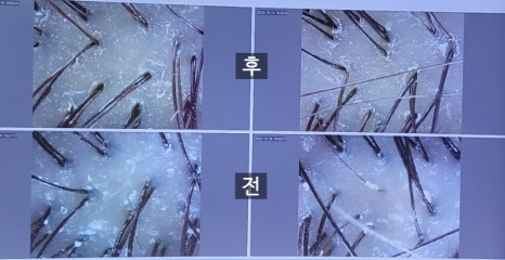 두핏 이미지
