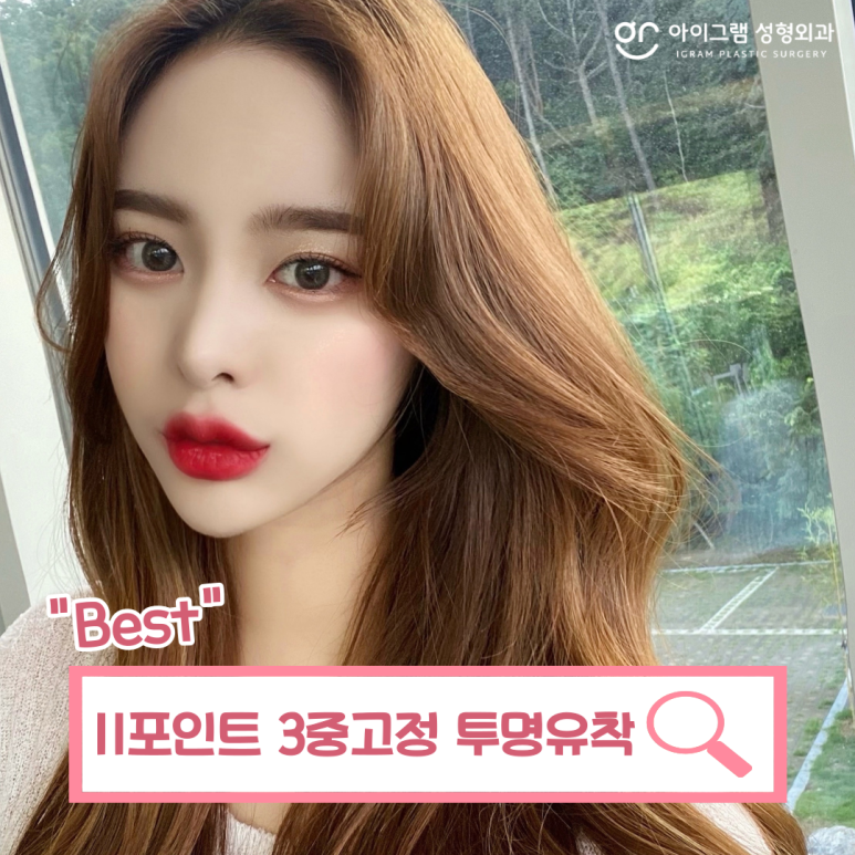 아이그램성형외과 이미지