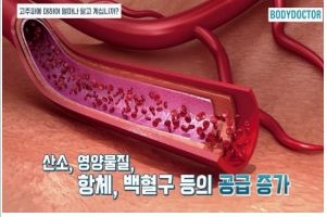 고주파 리페어 이미지