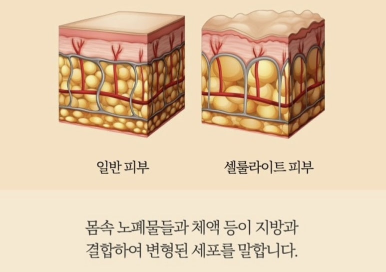 온바디 이미지