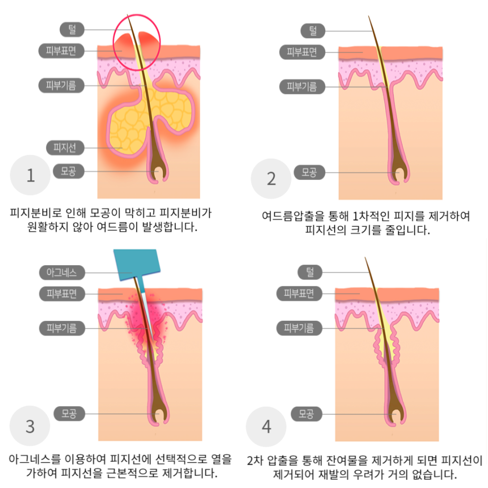 리즈힐의원 이미지