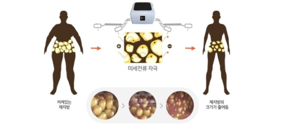에너지뷰티케어 이미지