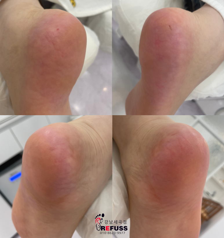 레푸스강남세곡점 이미지