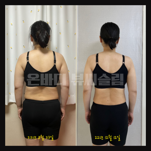 뷰씨슬림 이미지