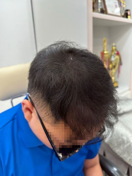 두피움 이미지