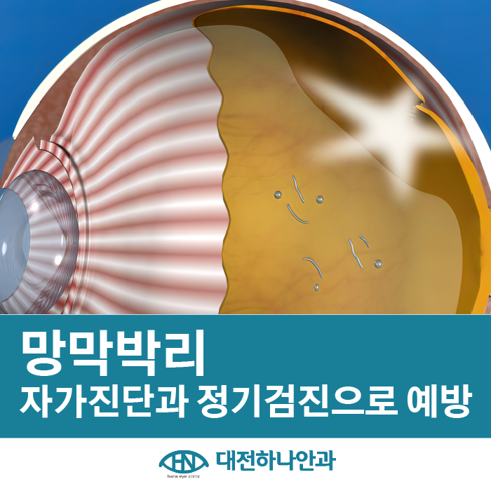 대전하나안과의원 이미지