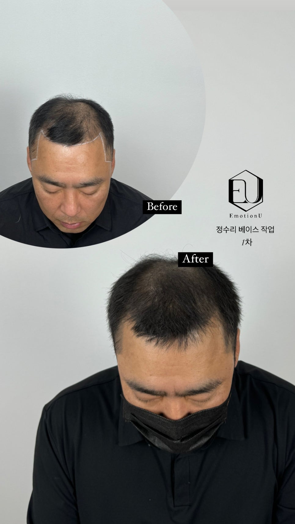 이모션유 이미지