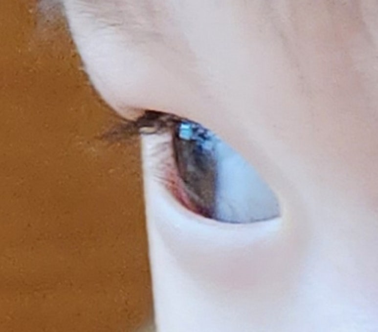 연세하늘안과의원 이미지