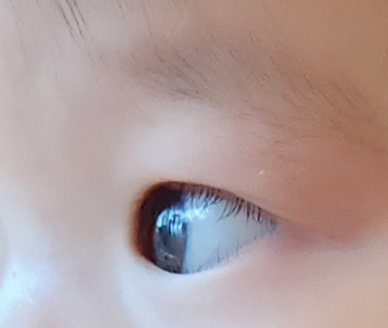 연세하늘안과의원 이미지
