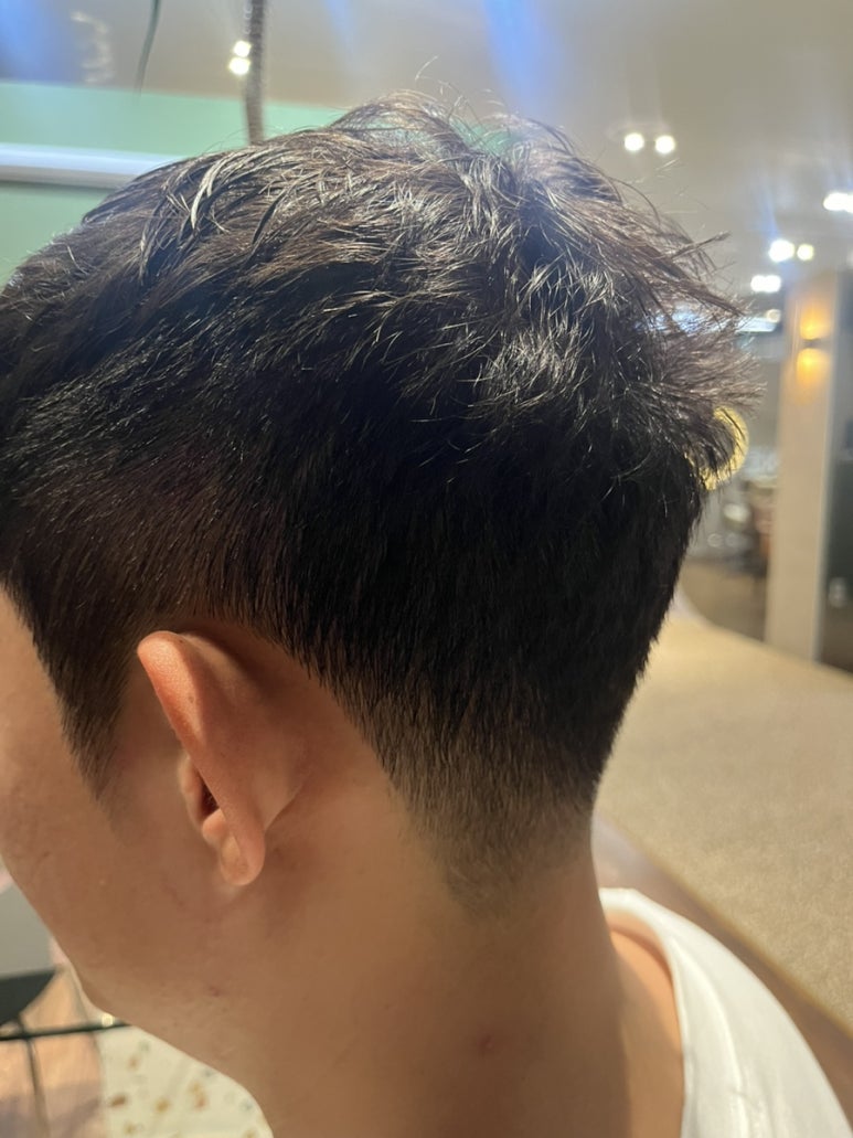 은지헤어라인 이미지