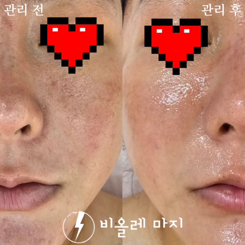 비올레 마지 이미지