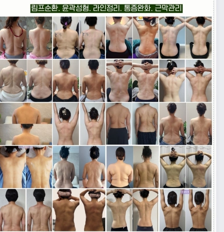 온바디 이미지