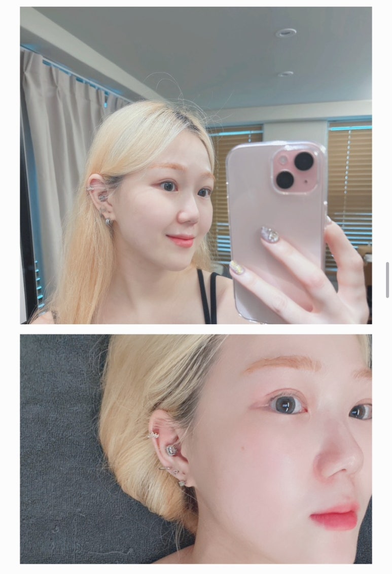 바이예진 이미지