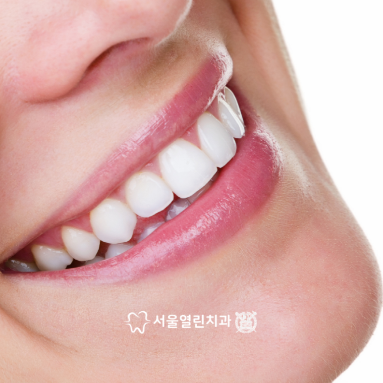서울열린치과 이미지