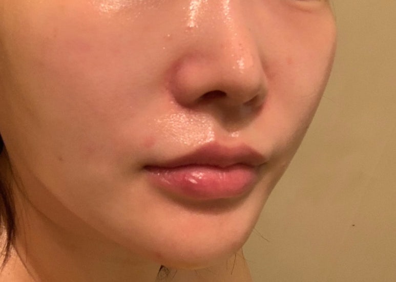 홍대신지윤피부관리 이미지