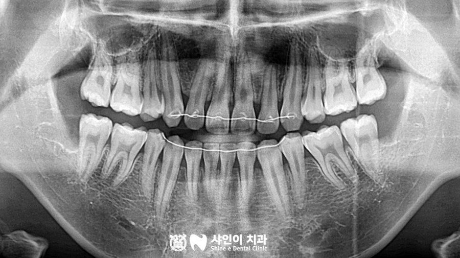 샤인이치과의원 이미지