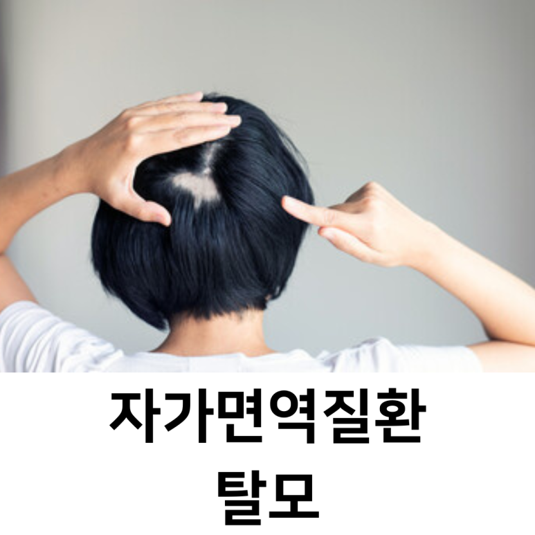 스칼프디자인센터마곡 이미지