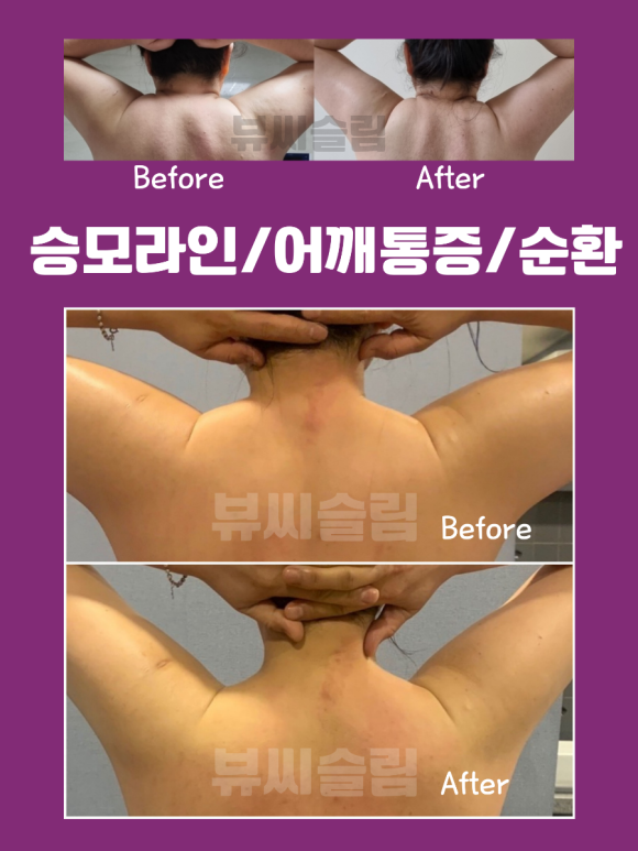 뷰씨슬림 이미지