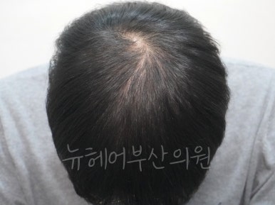 진뉴헤어 이미지