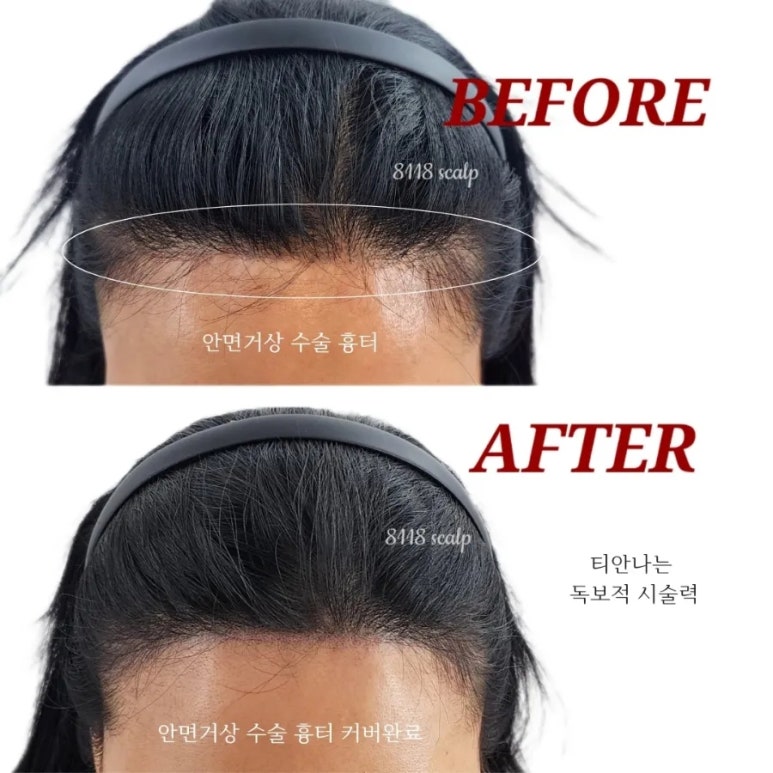헤어팡팡&가발 이미지
