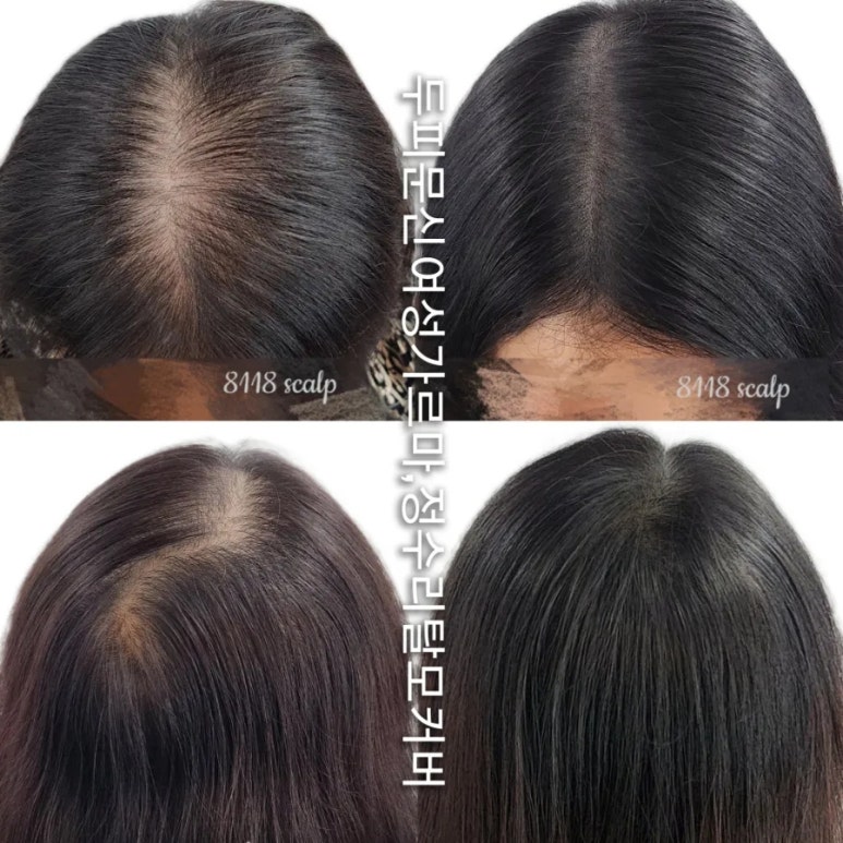헤어팡팡&가발 이미지