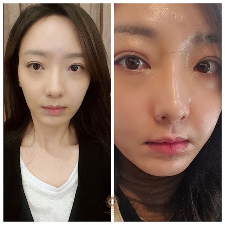 한성현콜라겐 이미지