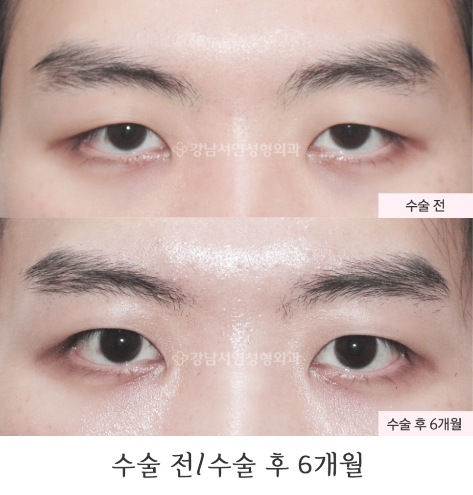 서연성형외과의원 이미지