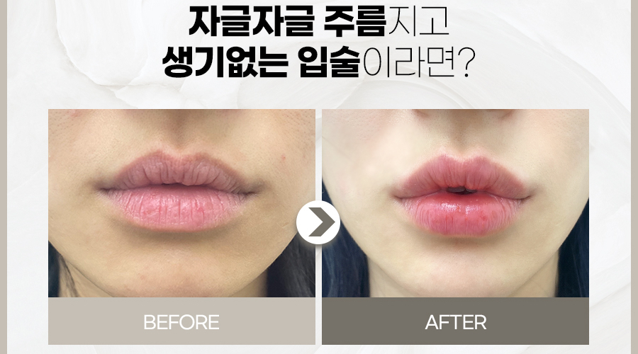 엔의원 이미지