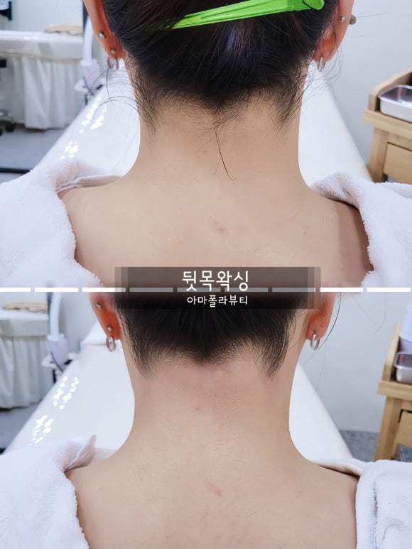 아마폴라뷰티 이미지