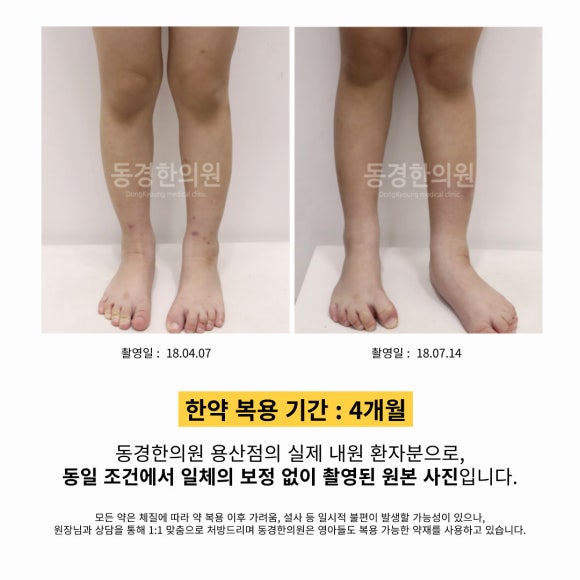 진소아 이미지