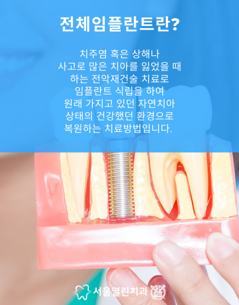 서울열린치과 이미지