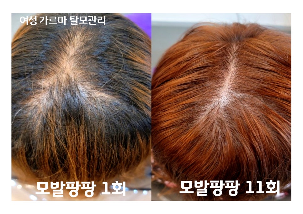 큐사랑 이미지
