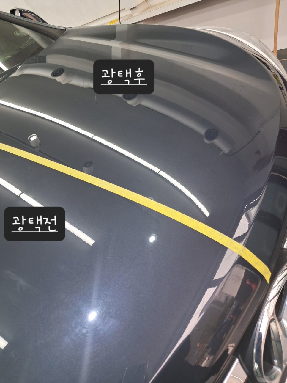 디테일링게러지 이미지