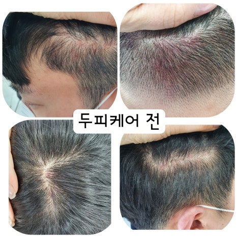 큐사랑 이미지