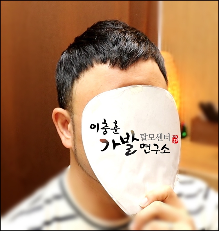 심는가발 이미지