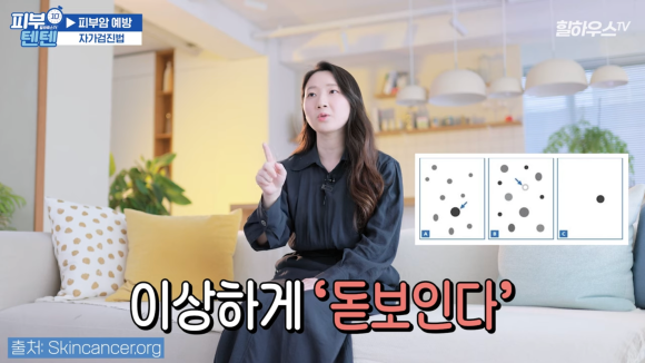 튀어나온 점, 피부암일까? 점 구별법, 점제거 치료 피부과 : 네이버 블로그