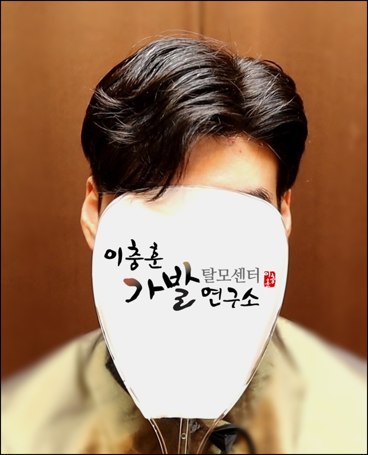 심는가발 이미지
