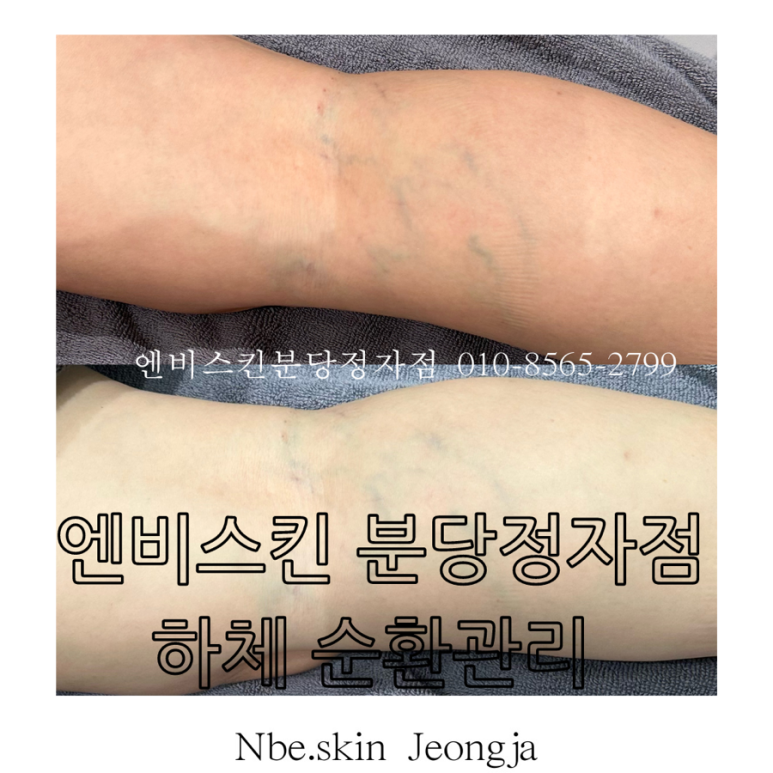엔비스킨 분당정자점 이미지