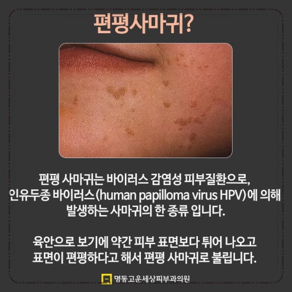 명동고운세상피부과의원 이미지