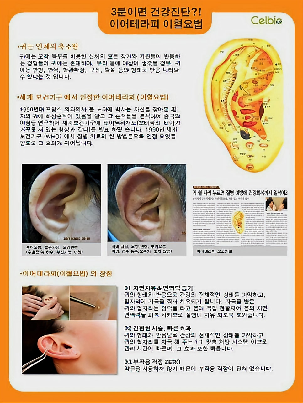 경혈테라피 이미지