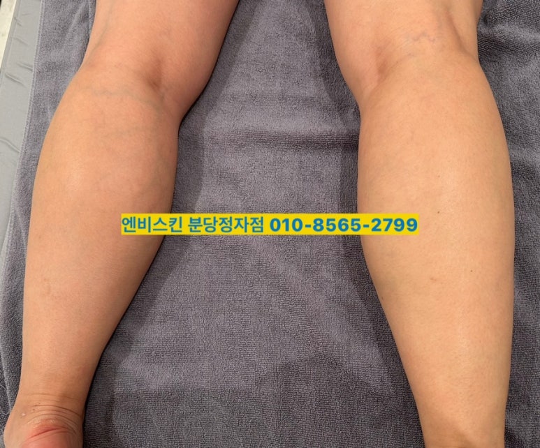 엔비스킨 분당정자점 이미지