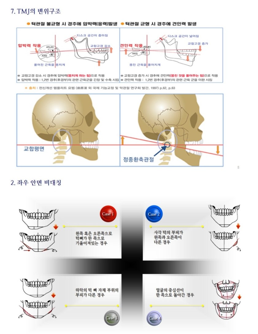 스파슈퍼 이미지