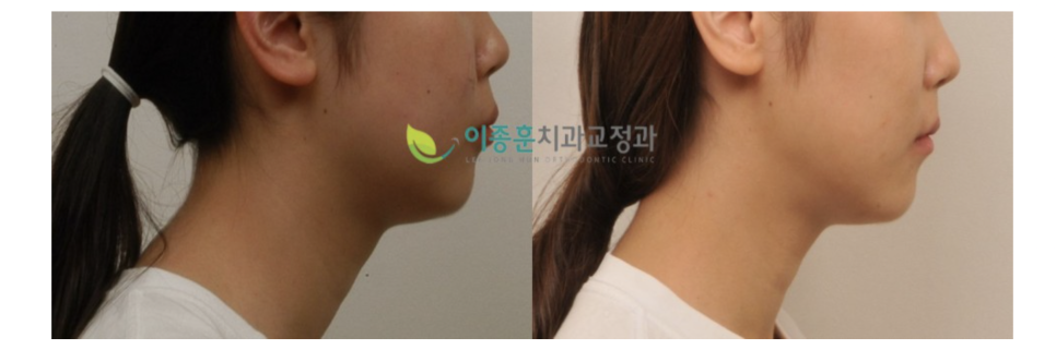 이종훈치과교정과치과의원 이미지