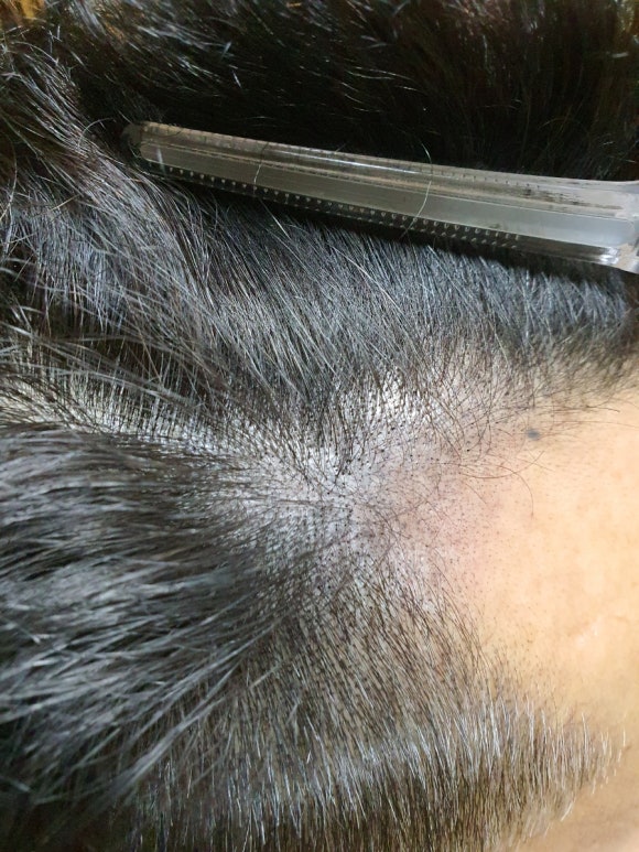 오느르헤어 이미지