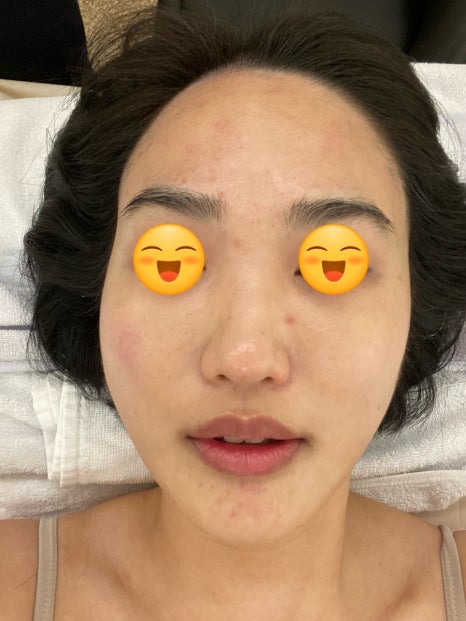 가림피부관리 이미지