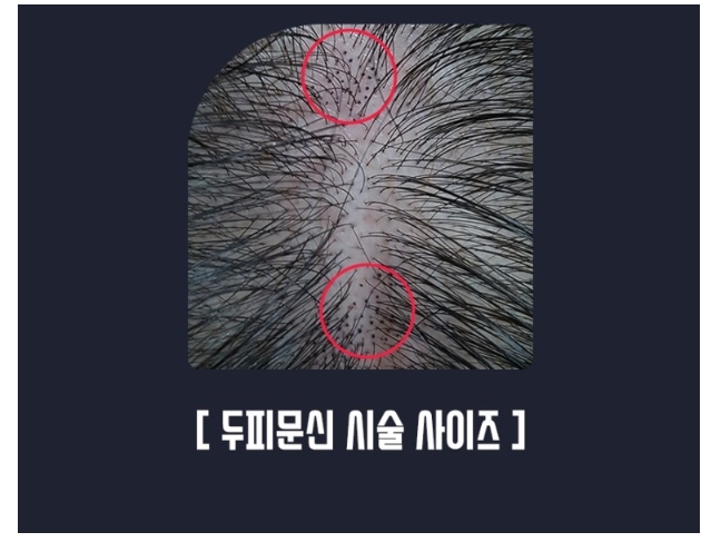 디에스엠피 이미지