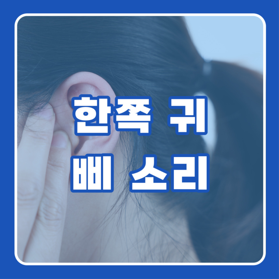 (주)엠아이제이 이미지