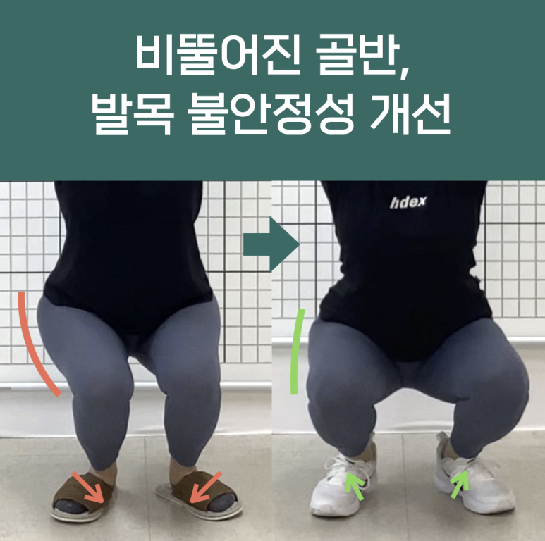 바디컨설팅 이미지