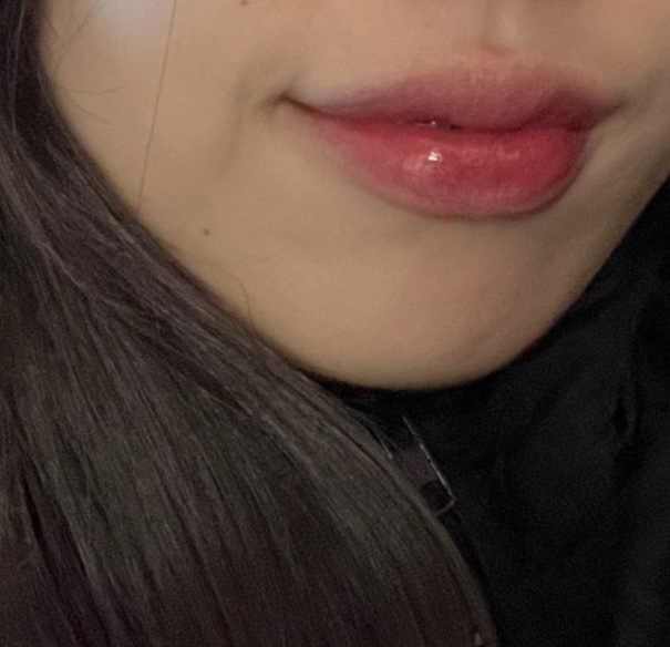 서울수석치과 이미지