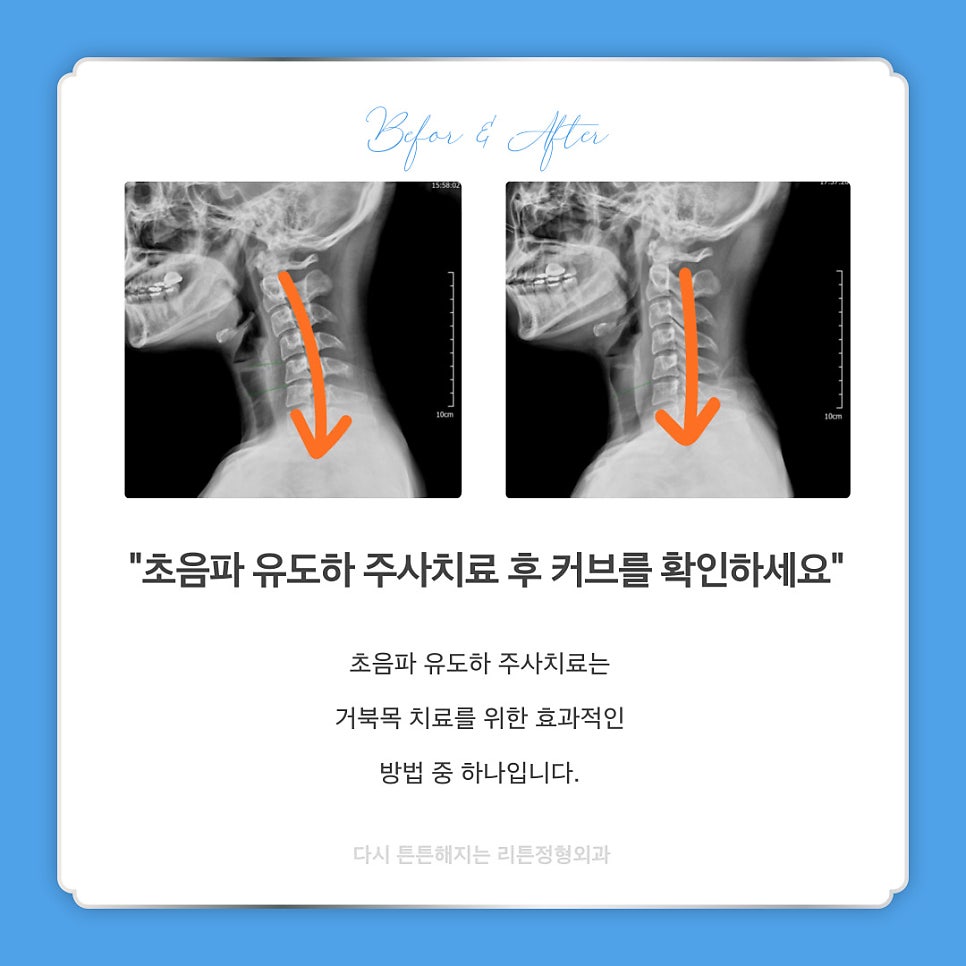천안튼튼정형외과 이미지